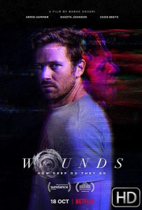 Wounds